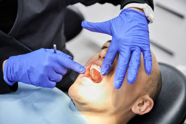 Best Emergency Treatment for Dental Infections or Abscesses in Riverside, CA
